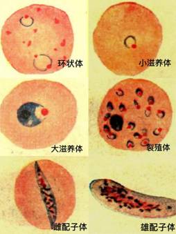疟原虫雌雄配子体图片图片